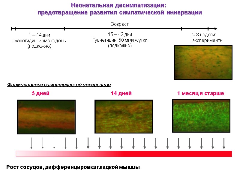 Неонатальная десимпатизация:  предотвращение развития симпатической иннервации Возраст 1 – 14 дни Гуанетидин 25мг/кг/день